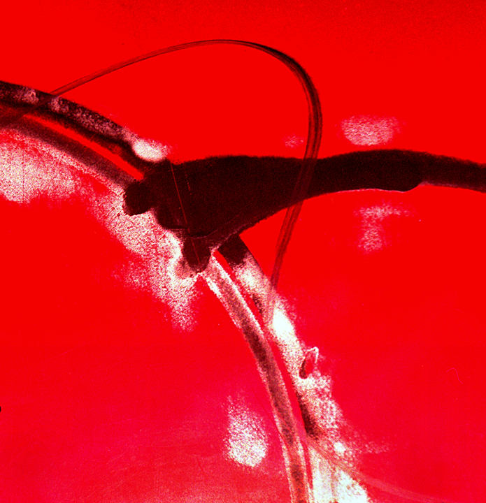 Metal 1
