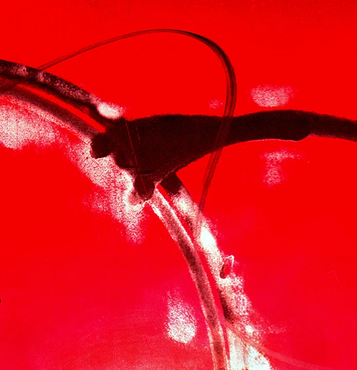 Metal 1